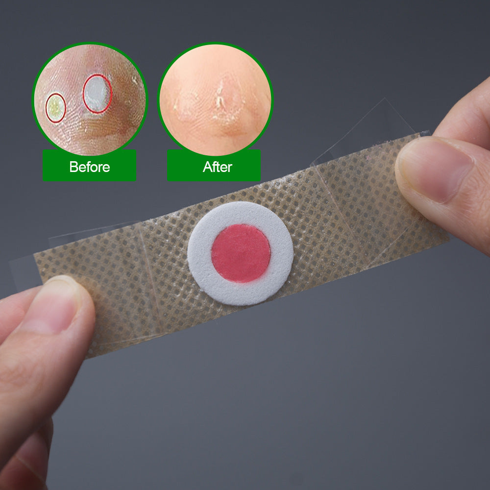 Foot Corn Removal Plaster